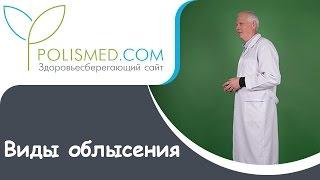 Виды облысения: гнездная, андрогенная (андрогенетическая), рубцовая, очаговая, диффузная, тотальная