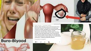 WAATAN DAWADA BURA BIYOODKA POLYCYSTIC OVARY SYNDROME PCOS