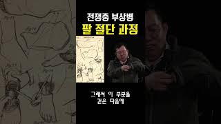 전쟁중 부상병의 팔 절단 과정