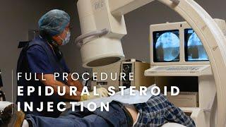 Epidural Steroid Injection For Chronic Pain Full Procedure