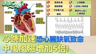 心跳加速恐心臟缺氧致命 中風風險增加5倍！ 健康2.0