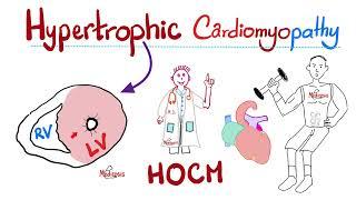 Hypertrophic Cardiomyopathy (HOCM) | Cardiology Series