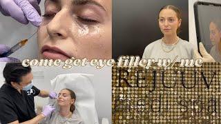 Come Get Under Eye Filler W/ Me @ Rejuuv Medi Spa