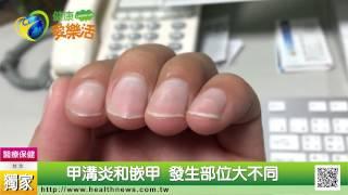 嵌甲甲溝炎大不同　皆不可輕忽