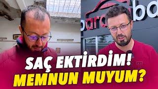 SAÇ EKTİRDİM 10 YAŞ FARK ETTİ!