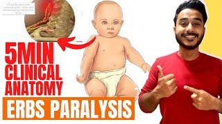 erbs paralysis clinical anatomy of brachial plexus | brachial plexus clinical anatomy