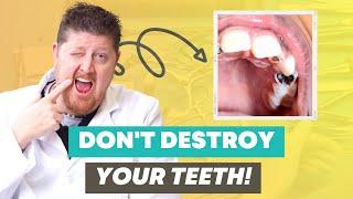 The Worst Dental Hygiene Myths Destroying Your Teeth! (What to do instead)