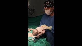 Cesariana gemelar/ Twin Caesarean Section