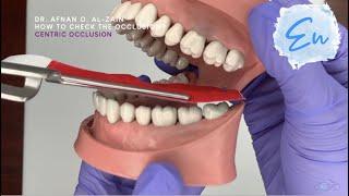 How to check the occlusion? - En