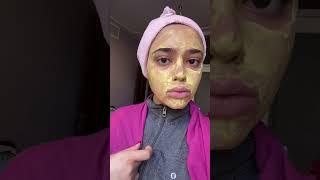 سریع ترین راه حل برای از بین بردن جوش ها/the fastest way to get rid of acnes