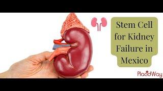 Improve Your Health with Stem Cell for Kidney Failure in Mexico