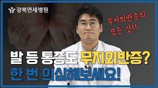 엄지발가락 통증, 발등통증 유발하는 무지외반증, 교정기로도 줄일 수 있다!?무지외반증 증상, 원인, 치료법 [강북연세병원TV]