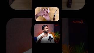 Skinless vs. Skin-On: Which Chicken Wins? | Telugu Podcast | Voice of Mogasala