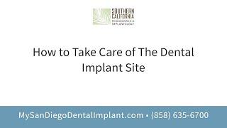 How to Take Care of The Dental Implant Site | Dr. Beck, Southern California Periodontist