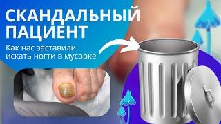 Скандальный пациент. Как нас заставили искать ногти в помойке. Реальная история!!