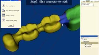 Dental CAD design - merge objects