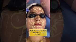 B.B Glow Treatment in Zirakpur | The Skin Zeal | Dr. Isha V. Mittal | Call 72-93-93-93-26