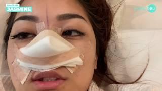 Jasmine's Rhinoplasty Surgery Experience with Eunogo | Part 1 | Banobagi Plastic Surgery x Eunogo