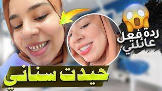 ضاعو سناني بسبب الولادة عائلتي تصدمو 