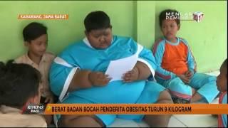 Arya Bocah Obesitas Berhasil Turunkan Berat Badan