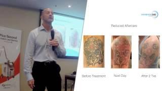 Advanced laser tattoo removal - Mixed Technology