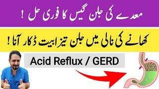 Gastroesophageal Reflux Disease In Urdu Hindi- Irfan Azeem