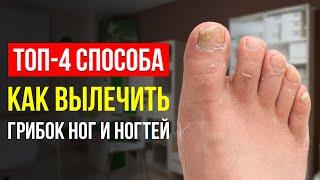 КАК ИЗБАВИТЬСЯ ОТ ГРИБКА НОГ И НОГТЕЙ? ГЛАВНЫЕ СОВЕТЫ, КАК ВЫЛЕЧИТЬ ГРИБОК (ЗНАЕТ ТОЛЬКО 1%)