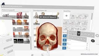 Measuring Distances in Virtual Reality: Precise Spatial Measurements in Medicalholodeck