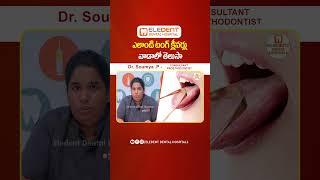 Tongue Cleaning Tips In Telugu || Oral Hygiene || Eledent Dental Hospitals #shorts #dentalcare