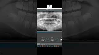 Dental 3D CT Can Create FMX in 14 Seconds #shorts