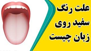 علت سفیدی روی زبان در طب سنتی و راههای درمانی آن