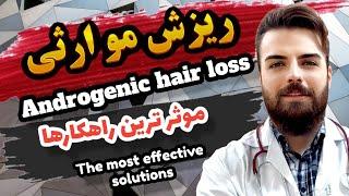 معجزه ریزش موی ارثی مردانه یکبار برای همیشه درمانش کن |Treat androgenic hair loss