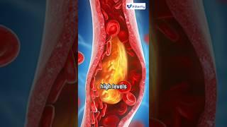 What is good and bad cholesterol? #shorts