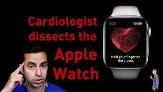 Cardiologist’s scientific analysis of the Apple Watch