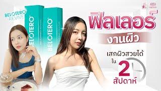 ANNA CLINIC | ฟิลเลอร์งานผิว Belotero Revive