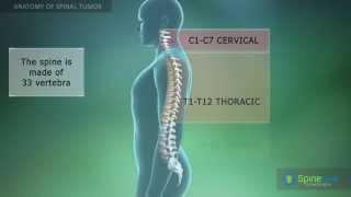 Spinal Tumor Anatomy