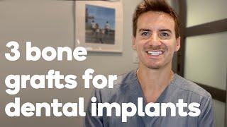 Can you get a dental implant if you have bone loss?