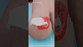 Truth About Ingrown Nails: Explained in 3D Animation #shorts #animation