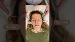 Acupuncture for Anxiety & Insomnia