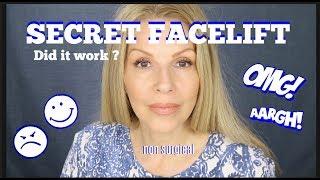 My "Facelift"  Experience | Bye Bye Jowls | Tammy's Ageless Beauty