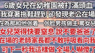 【完结】6歲女兒在幼稚園被打滿頭血，我趕到 卻發現老公在場，在為那和他一張臉男孩做主 罵女兒，女兒哭得 說不要爸爸了，在場老師家長都不敢呼吸看向我，下一秒我這樣做 全場人嚇傻【爽文】【爱情】【豪门】