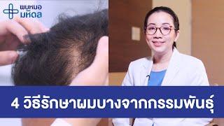 4 วิธีรักษาผมบางจากกรรมพันธุ์ | พบหมอมหิดล [by Mahidol Channel]