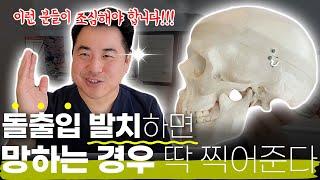 돌출입 발치하면 망하는 경우 딱 찍어준다!!!