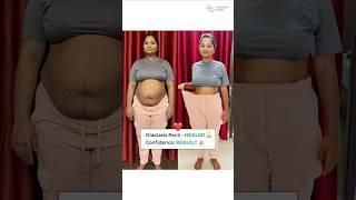 17 kg weight loss and belly fat gone! Diastasis Recti healed | MyHealthBuddy