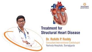 Treatment of Structural Heart Disease | Yashoda Hospitals Hyderabad