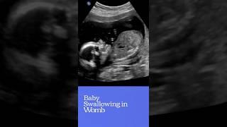 #Babyswallowinginwomb#pregnancy#babyinwomb