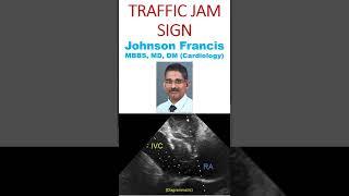 Traffic jam sign