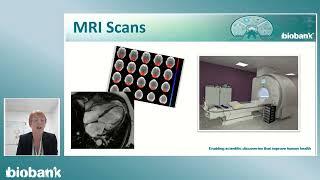 What happens during your UK Biobank imaging visit