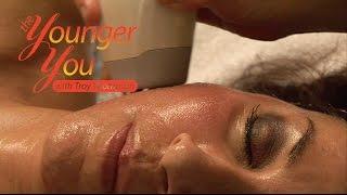 The Younger You With Troy Thompson - Episode 09 Skin Resurfacing