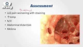 Diverticulosis & Colostomy NCLEX® Review | NURSING.com (NRSNG) Academy